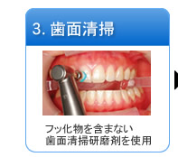 3.歯面清掃